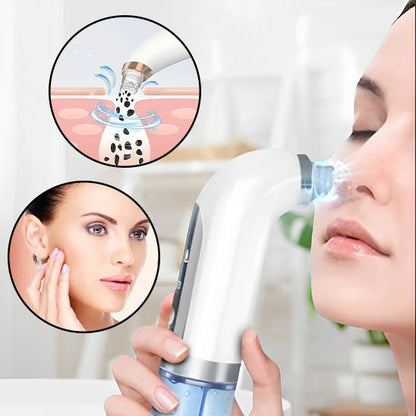 aspirateur point noir | PureDerma - Beautefutee