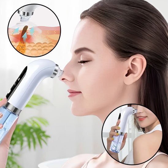 aspirateur point noir | PureDerma - Beautefutee